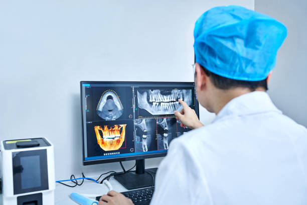 Best Knocked-Out Tooth (Avulsed Tooth) Treatment in Selma, CA